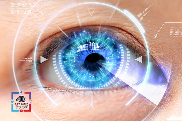 HD lASIK