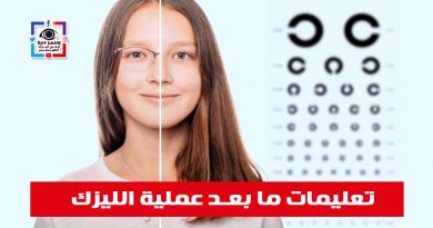 after lasik