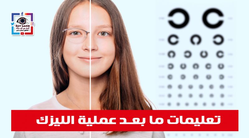 after lasik