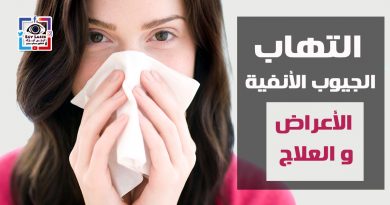 sinusitis