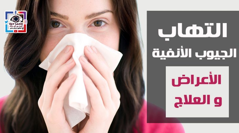 sinusitis