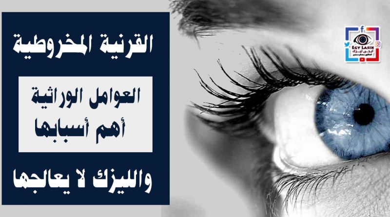 keratoconus-symptoms