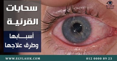 Corneal zippers