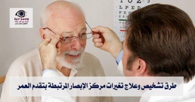 age-related-macular-degeneration