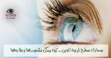 corneal opacity
