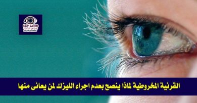 keratoconus-and-lasik