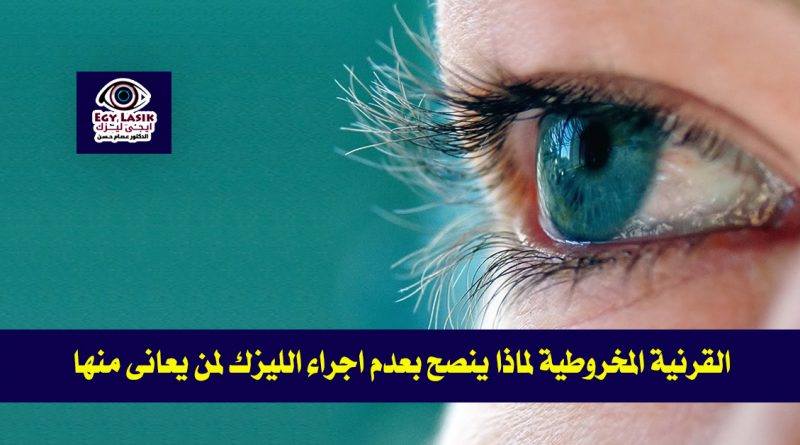keratoconus-and-lasik