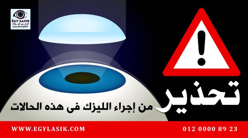 lasik forbidden