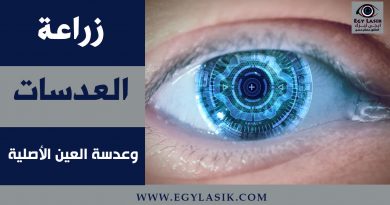 lenses implant cases