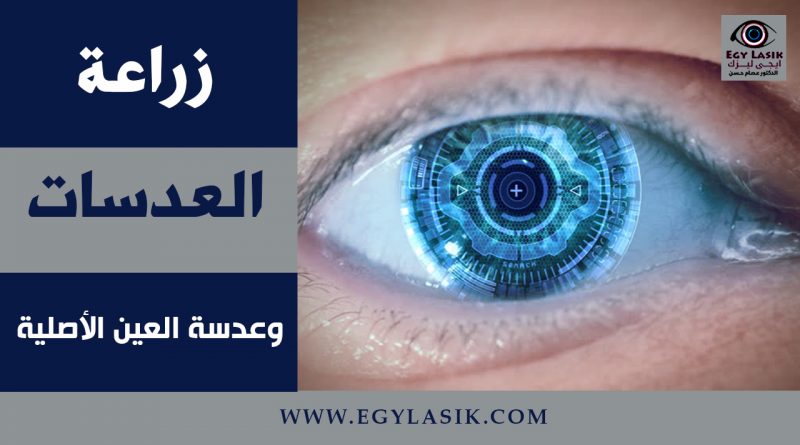 lenses implant cases