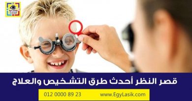 nearsightedness-myopia