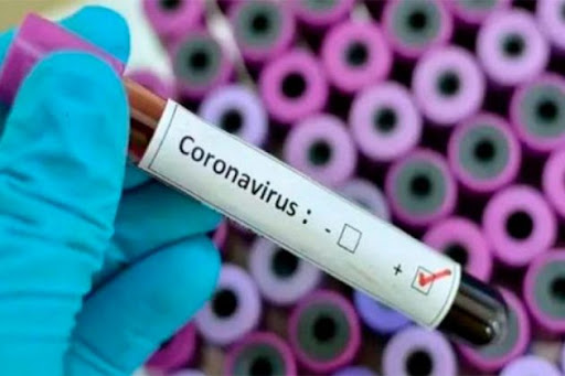 coronavirus22