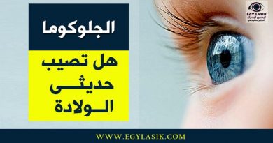 glaucoma-in-babies