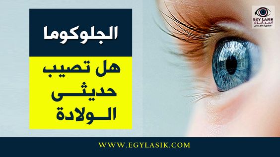 glaucoma-in-babies