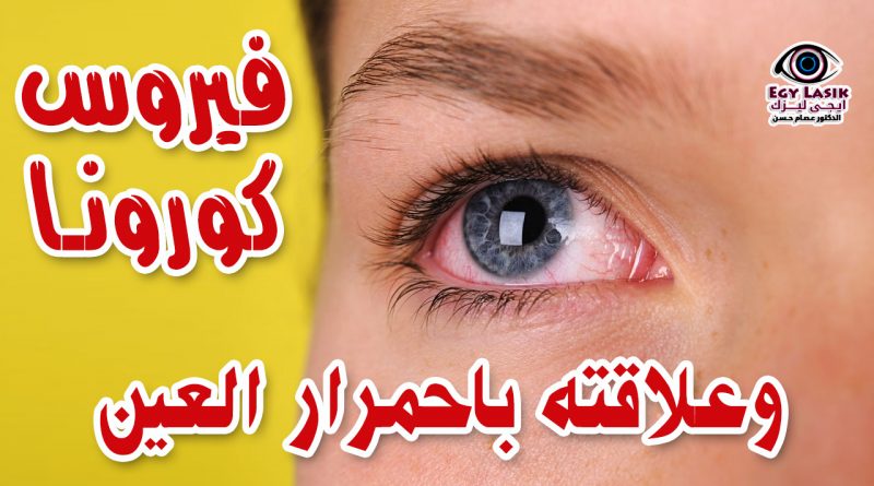 coronavirus and red eye