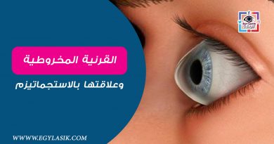 keratoconus-lasik