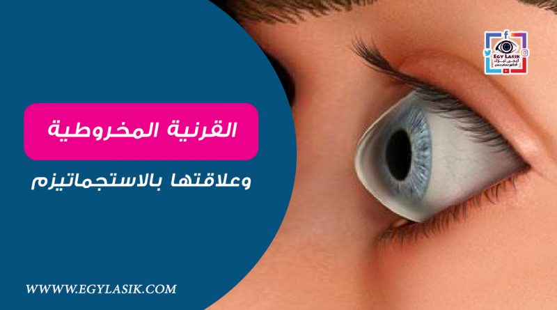 keratoconus-lasik
